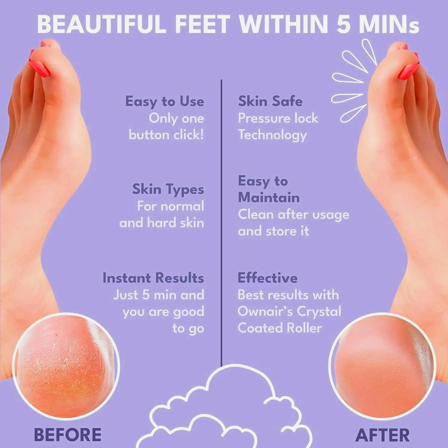 Buy Ownair Electric Callus Remover For Feet | Mani-Pedi Kit